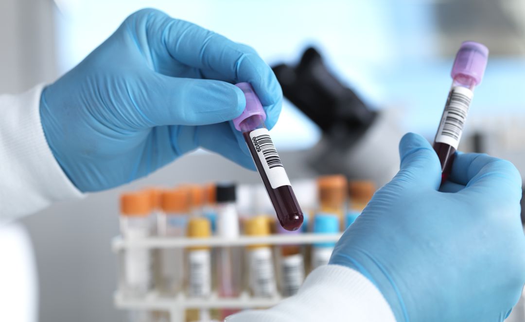 Una farmacéutica quiere evitar en los tribunales que el Gobierno haga públicos los datos sobre la aprobación de uno de sus medicamentos Una farmacéutica quiere evitar en los tribunales que el Gobierno haga públicos los datos sobre la aprobación de uno de sus medicamentos