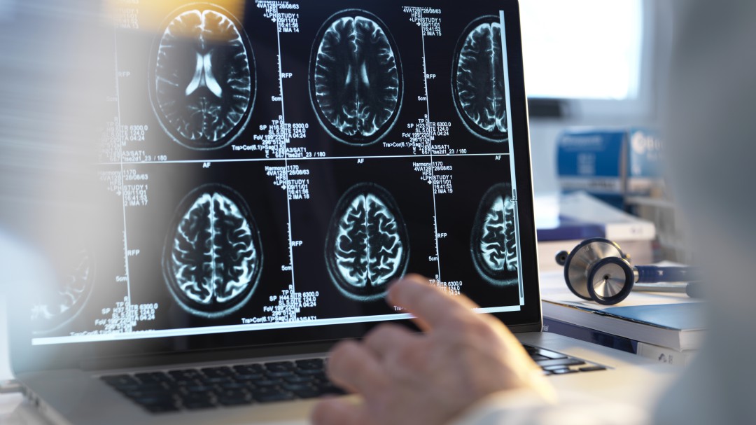 Un paso más cerca de controlar dispositivos electrónicos con las ondas cerebrales