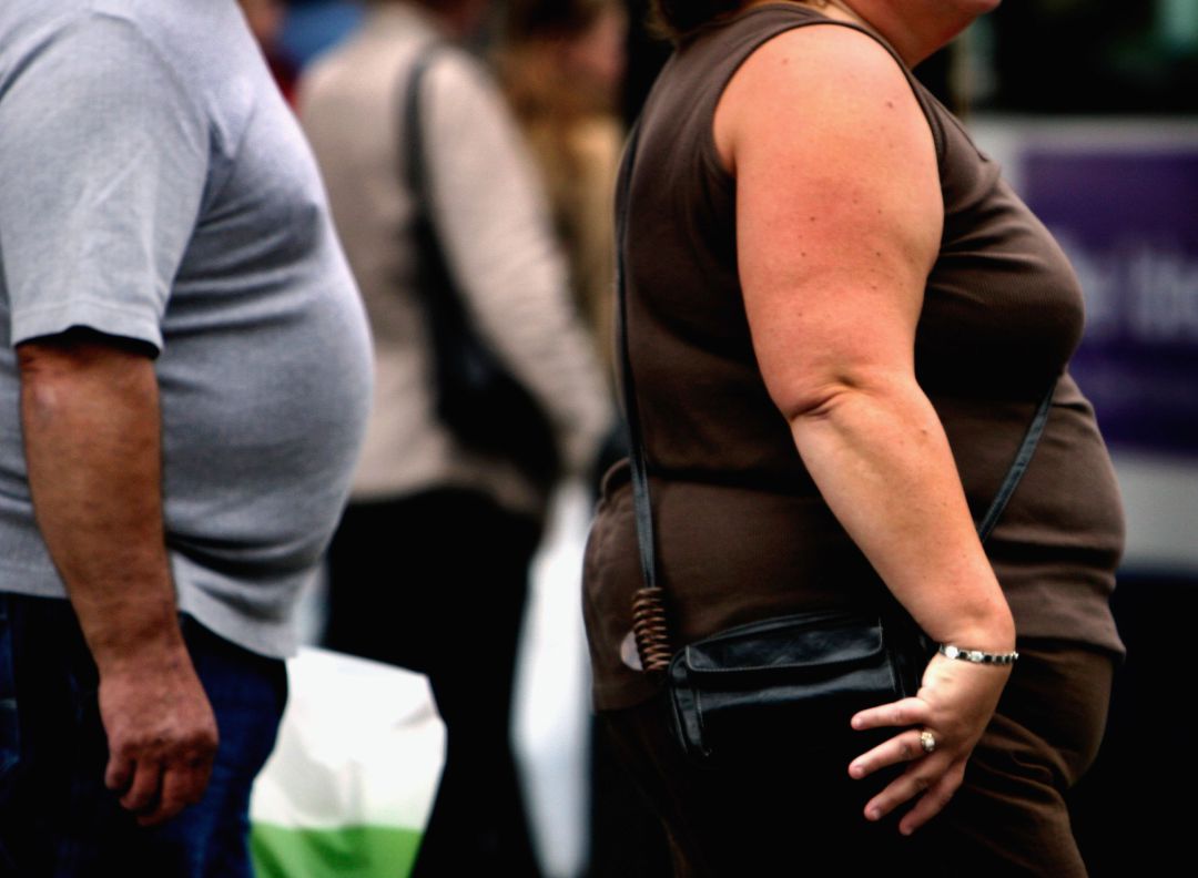 SER Consumidor: La obesidad SER Consumidor: La obesidad