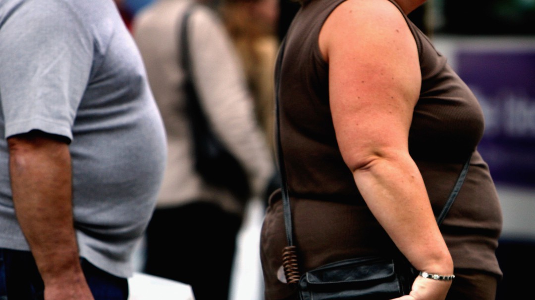 SER Consumidor: La obesidad
