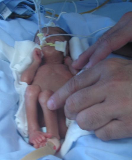 La mano de Juan Carlos junto al cuerpo de su hija Stella, al poco de nacer prematuramente La mano de Juan Carlos junto al cuerpo de su hija Stella, al poco de nacer prematuramente