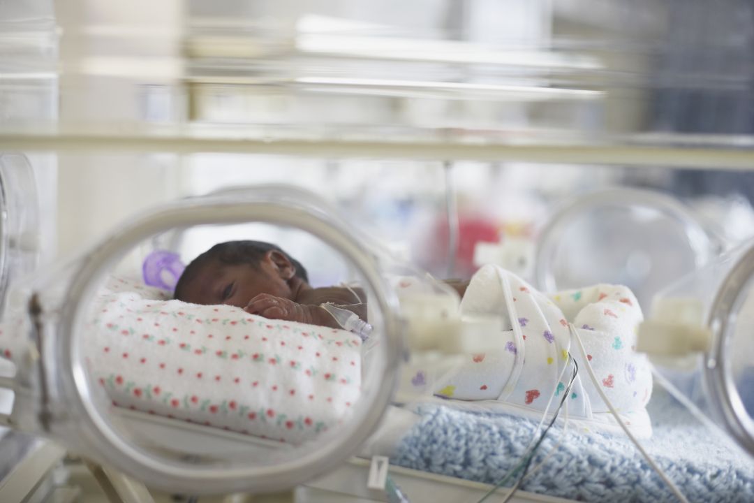 Ahora nacen un 36% más de niños prematuros que hace 20 años Ahora nacen un 36% más de niños prematuros que hace 20 años