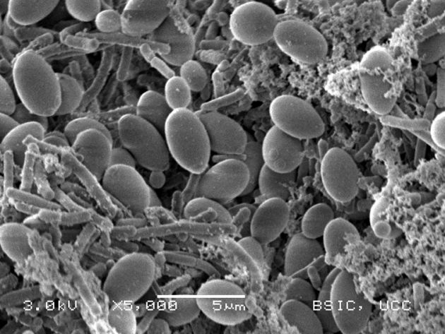 Las células de la levadura de leche tienen una forma alargada y ovalada. Aquí aparecen rodeadas por células bacterianas con forma de bastoncillo. Las células de la levadura de leche tienen una forma alargada y ovalada. Aquí aparecen rodeadas por células bacterianas con forma de bastoncillo.