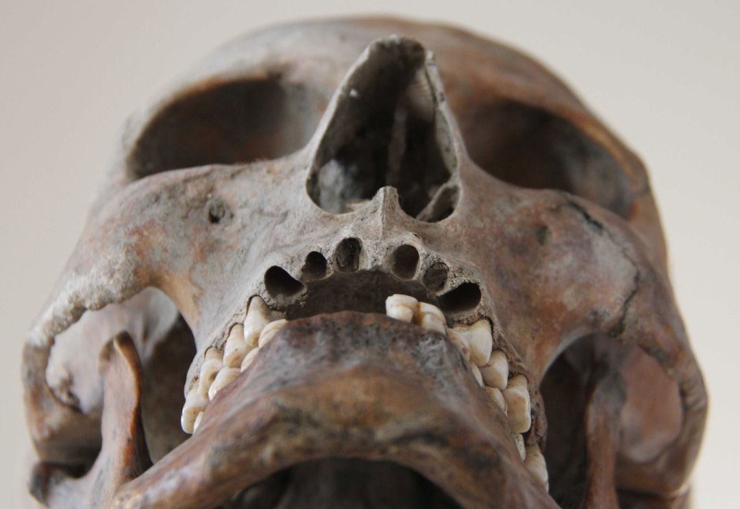 Calavera encontrada en el antiguo Rungholt Calavera encontrada en el antiguo Rungholt