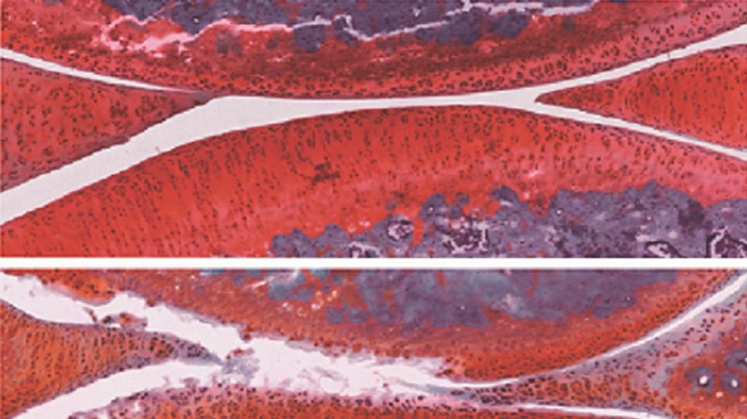 Izpisúa logra revertir la artritis mediante la combinación de dos fármacos experimentales