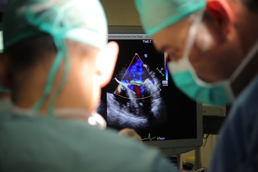 Un equipo de cirujanos realiza una operación de corazón.
Un equipo de cirujanos realiza una operación de corazón.