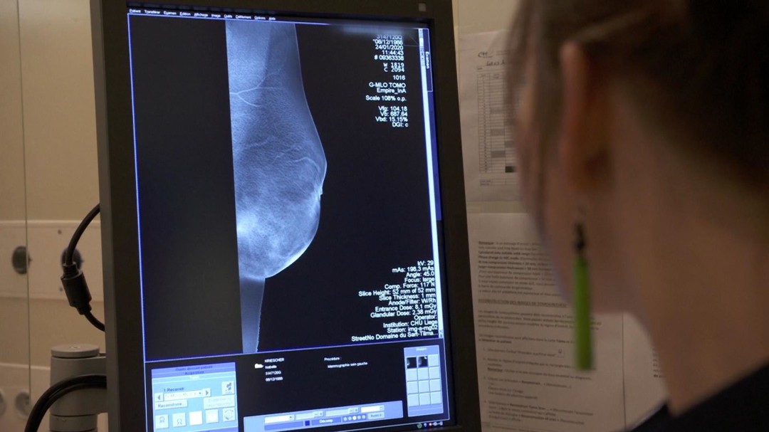 Un estudio genético abre la puerta a que el cáncer pueda detectarse mucho antes de que aparezca