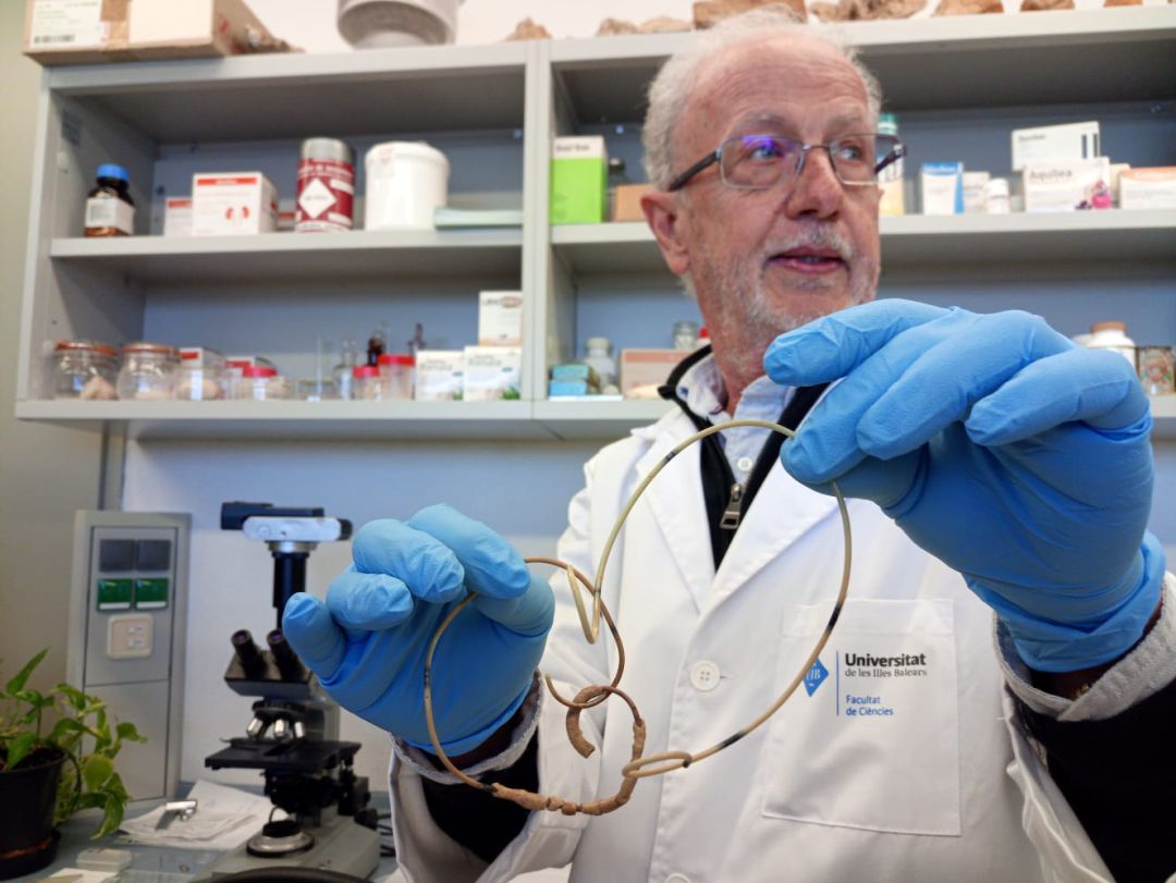 Doctor de la UIB, Fèlix Grases, con una muestra de dos catéteres, el de la izquierda está obstruido. Doctor de la UIB, Fèlix Grases, con una muestra de dos catéteres, el de la izquierda está obstruido.