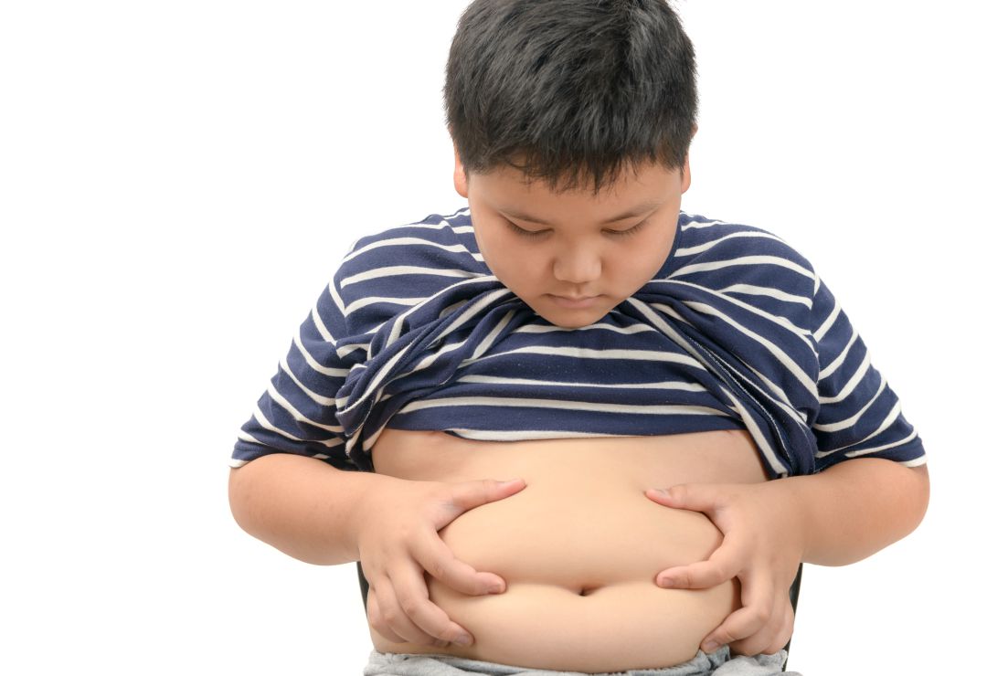 Niño con sobrepeso Niño con sobrepeso