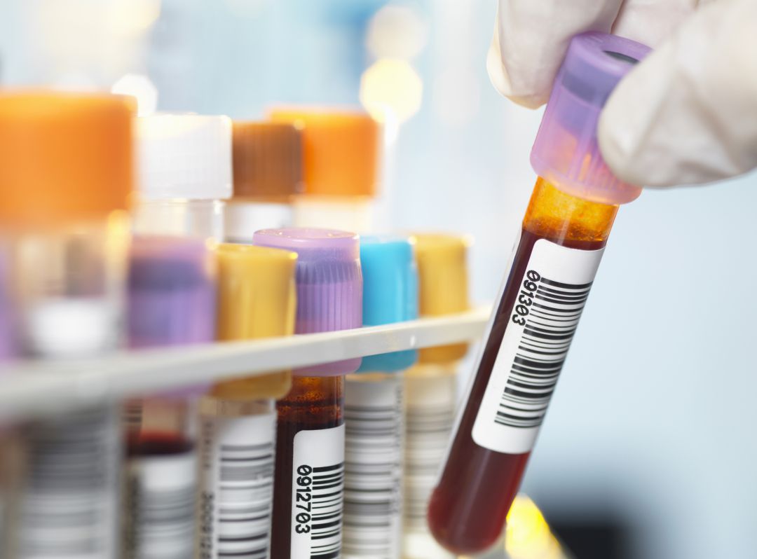 Los pacientes aislados en el Hospital Río Carrión en Palencia dan negativo en coronavirus Los pacientes aislados en el Hospital Río Carrión en Palencia dan negativo en coronavirus