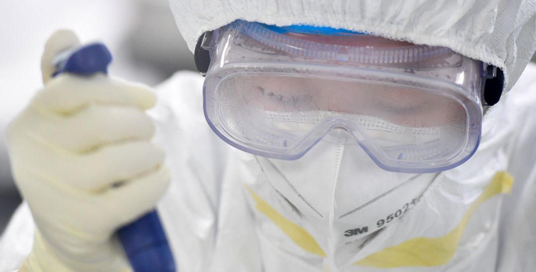 Las gafas empañadas del médico Feng Limin después de trabajar durante mucho tiempo en el Centro de Diagnóstico, Virología y Transformación de la Guangzhou KingMed Diagnostics Group Co., Ltd. En Guangzhou. 18 de febrero de 2020 Las gafas empañadas del médico Feng Limin después de trabajar durante mucho tiempo en el Centro de Diagnóstico, Virología y Transformación de la Guangzhou KingMed Diagnostics Group Co., Ltd. En Guangzhou. 18 de febrero de 2020