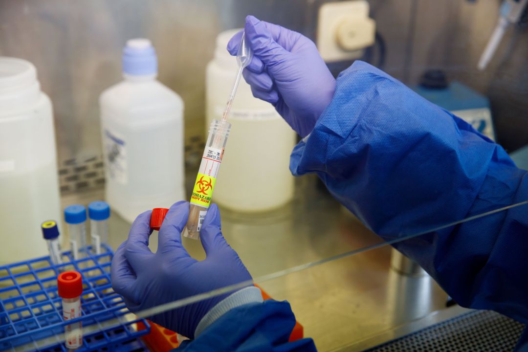 Imagen de un investigador sobre el coronavirus. Imagen de un investigador sobre el coronavirus.