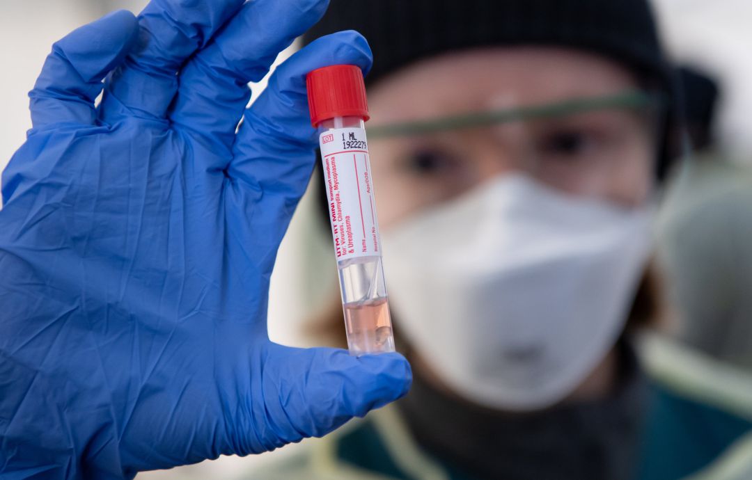 Una persona sostiene una muestra de un test de coronavirus Una persona sostiene una muestra de un test de coronavirus