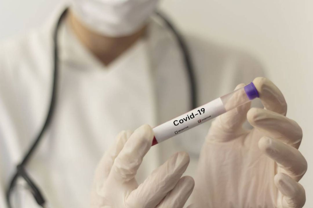 Pandemia Covid 19. Pandemia Covid 19.