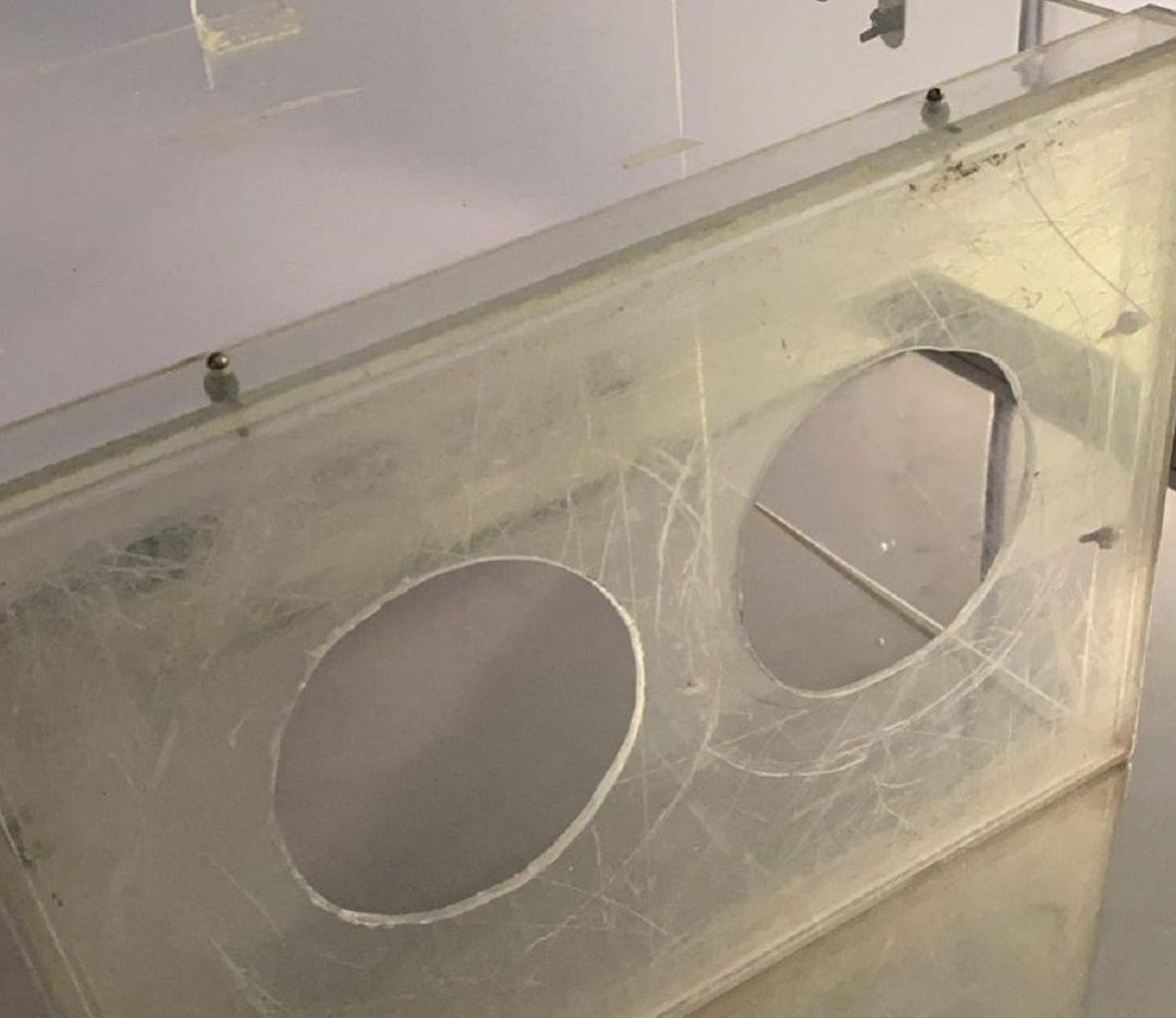 El hospital público de Galdakao ha comenzado a utilizar urnas de votación para evitar que los pacientes de coronavirus más graves puedan contagiar la enfermedad al personal sanitario El hospital público de Galdakao ha comenzado a utilizar urnas de votación para evitar que los pacientes de coronavirus más graves puedan contagiar la enfermedad al personal sanitario