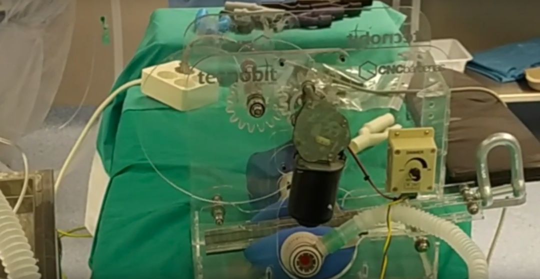 Primer prototipo de respirador automático para Hospitales Primer prototipo de respirador automático para Hospitales