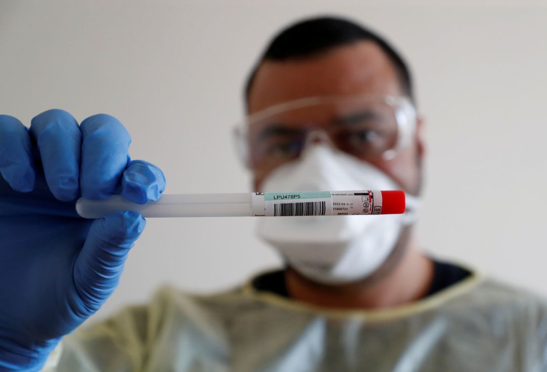 Científicos del País Vasco validan un test alternativo de RT-PCR para detección de COVID-19 Científicos del País Vasco validan un test alternativo de RT-PCR para detección de COVID-19