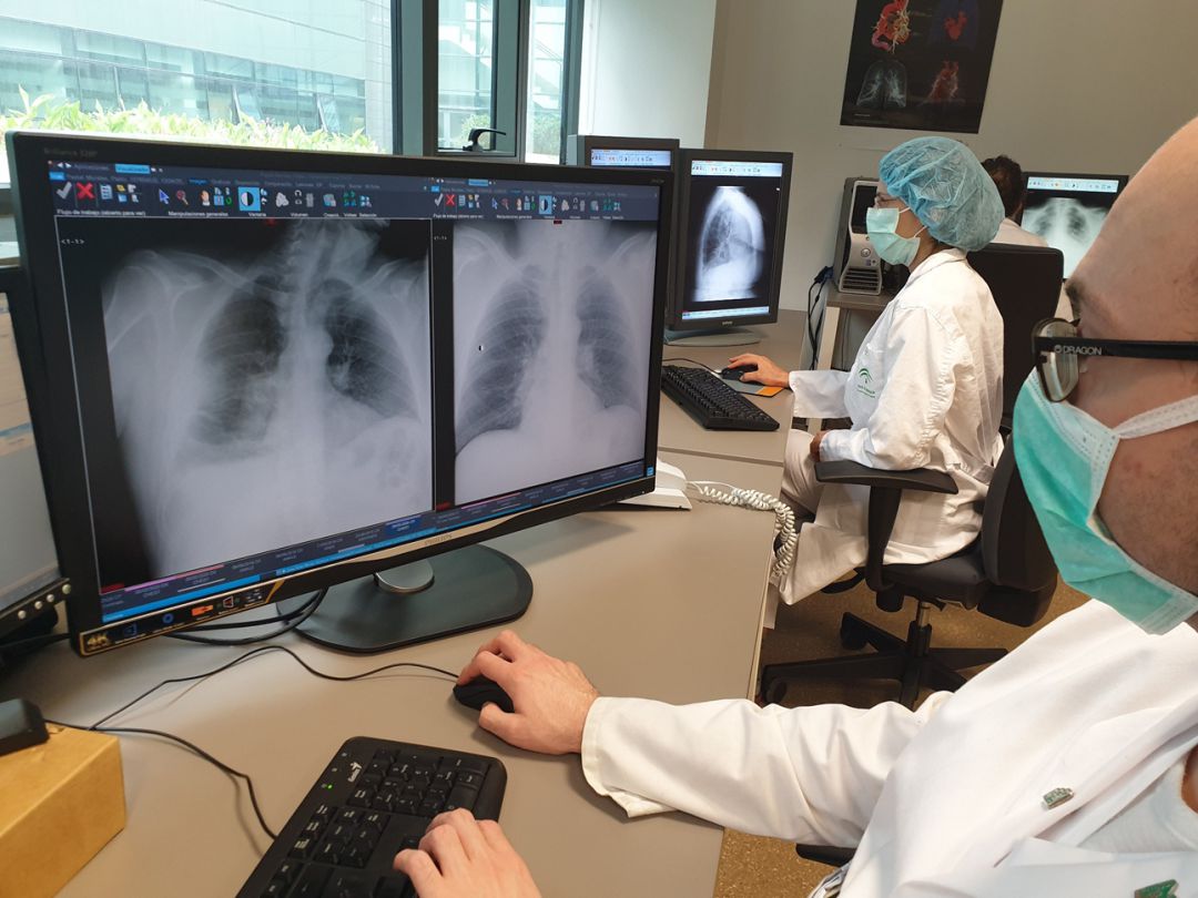 Sistema de intelligencia artificial que detecta coronavirus estudiando las placas de tórax de pacientes implementado por investigadores de la Universidad de Granada (UGR) y el hospital San Cecilio de Granada Sistema de intelligencia artificial que detecta coronavirus estudiando las placas de tórax de pacientes implementado por investigadores de la Universidad de Granada (UGR) y el hospital San Cecilio de Granada