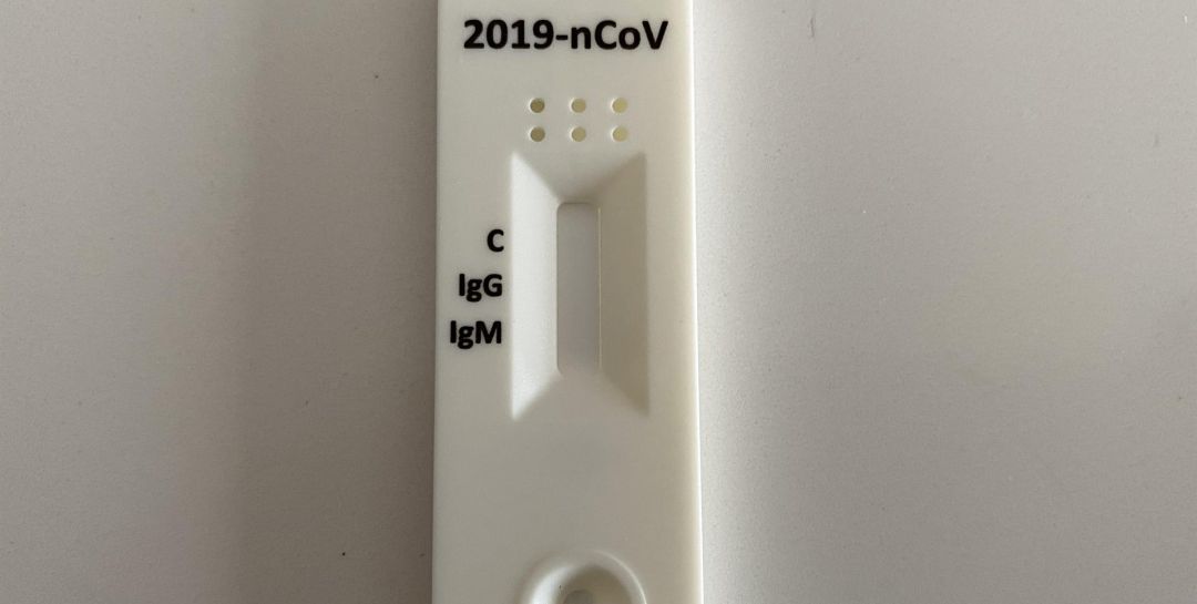 Imagen de una prueba para detectar el Covid-19 Imagen de una prueba para detectar el Covid-19