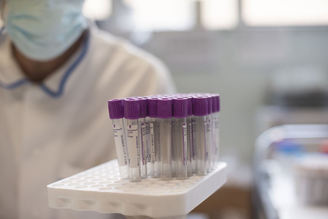 Tubos para recoger muestras analíticas Tubos para recoger muestras analíticas