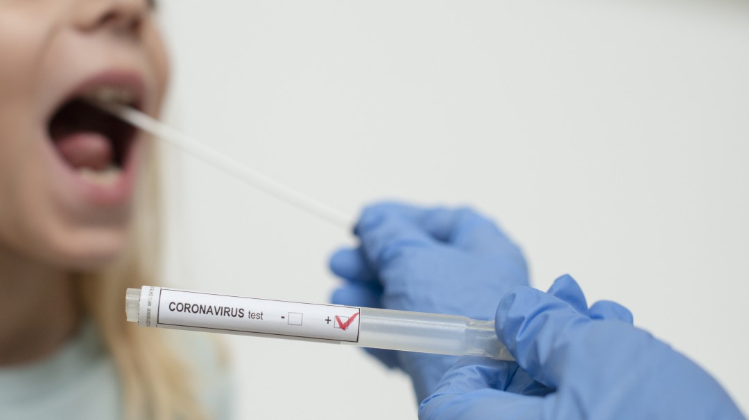 La patronal facilitará la realización de test en las empresas aragonesas