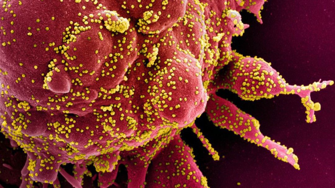 El coronavirus SARS-CoV-2 ha mutado ya 198 veces