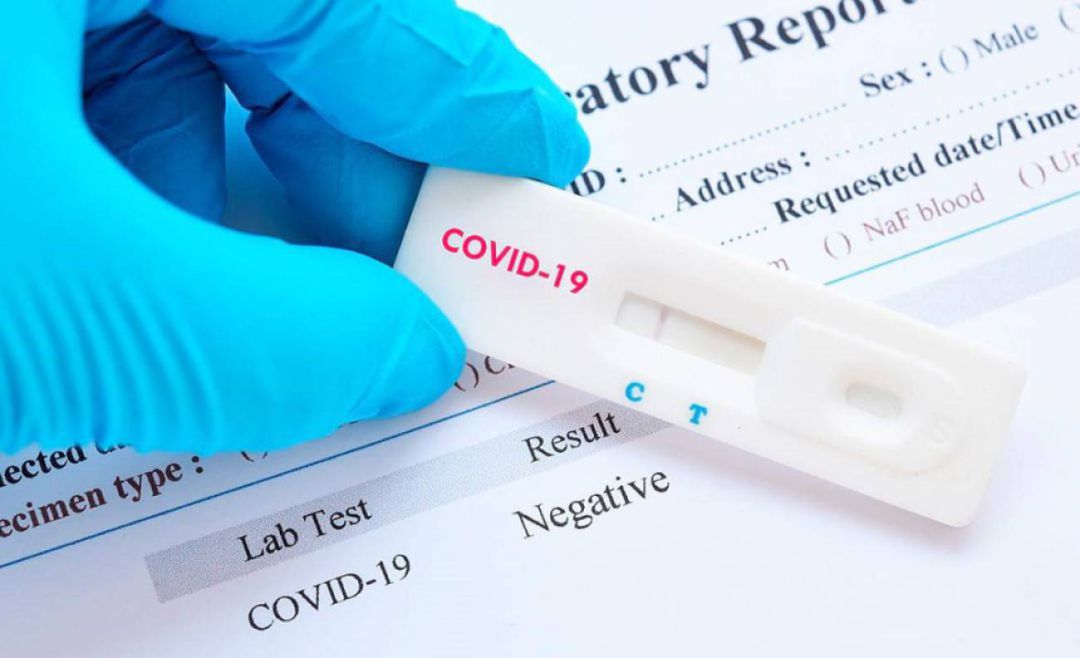 Test de detección del coronavirus Test de detección del coronavirus
