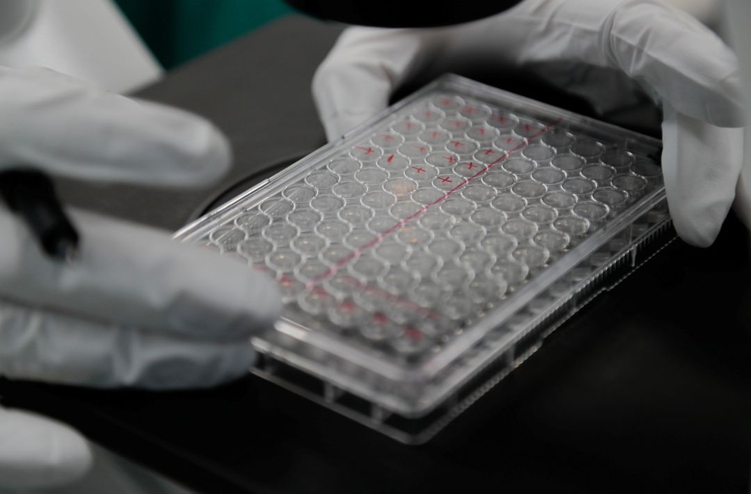 Imagen de archivo de pruebas para una vacuna del coronavirus Imagen de archivo de pruebas para una vacuna del coronavirus