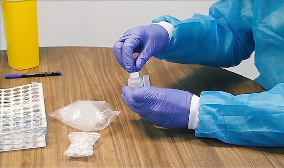 Análisis PCR Análisis PCR