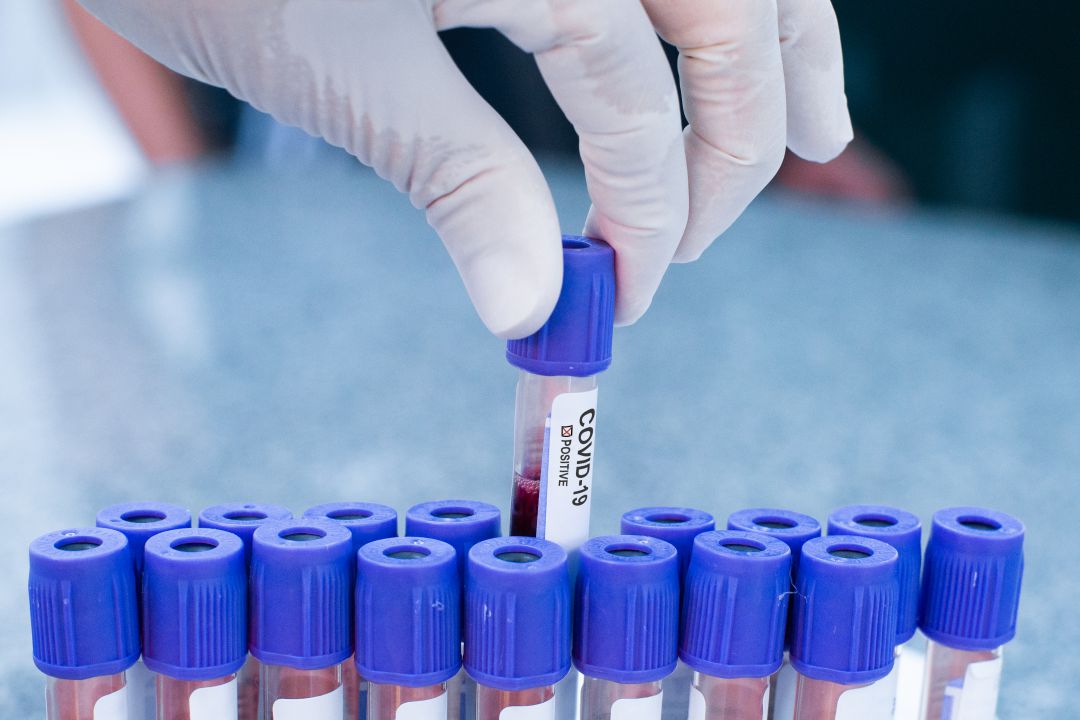 Muestras de sangre para realizar pruebas de COVID-19 en un laboratorio. Muestras de sangre para realizar pruebas de COVID-19 en un laboratorio.