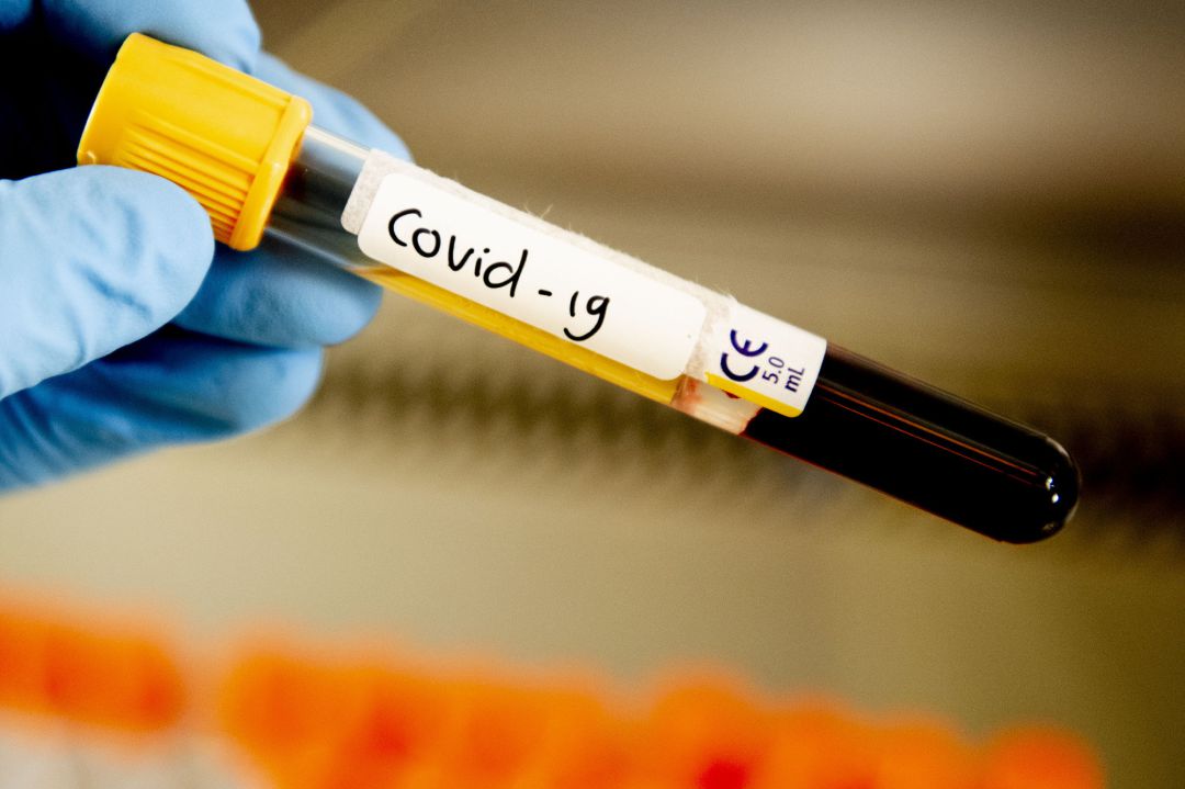 Prueba del covid en las manos de un sanitario. Prueba del covid en las manos de un sanitario.