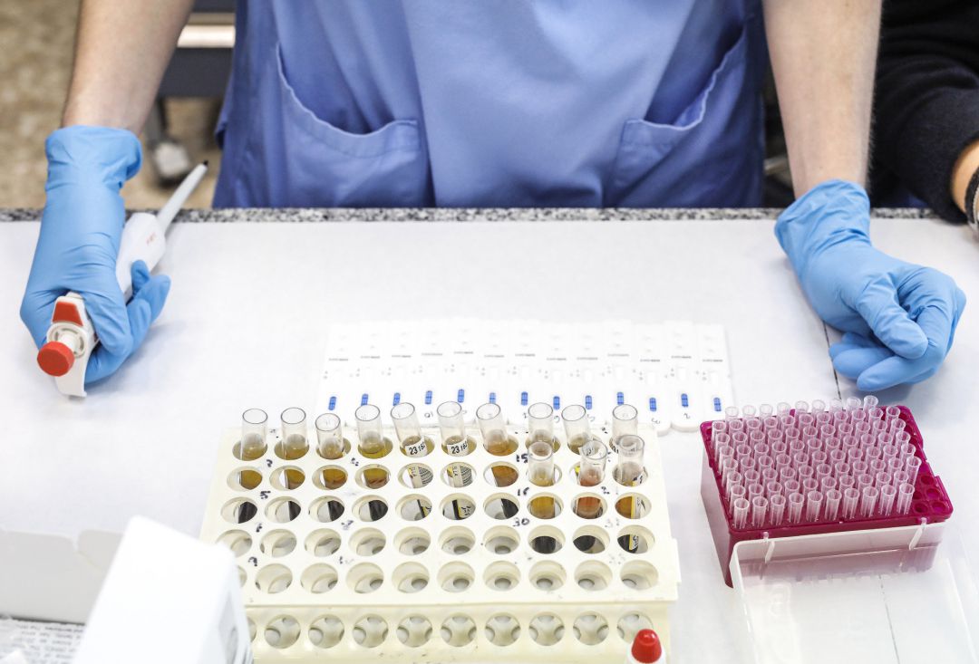 Pruebas del coronavirus en manos de un sanitario. Pruebas del coronavirus en manos de un sanitario.