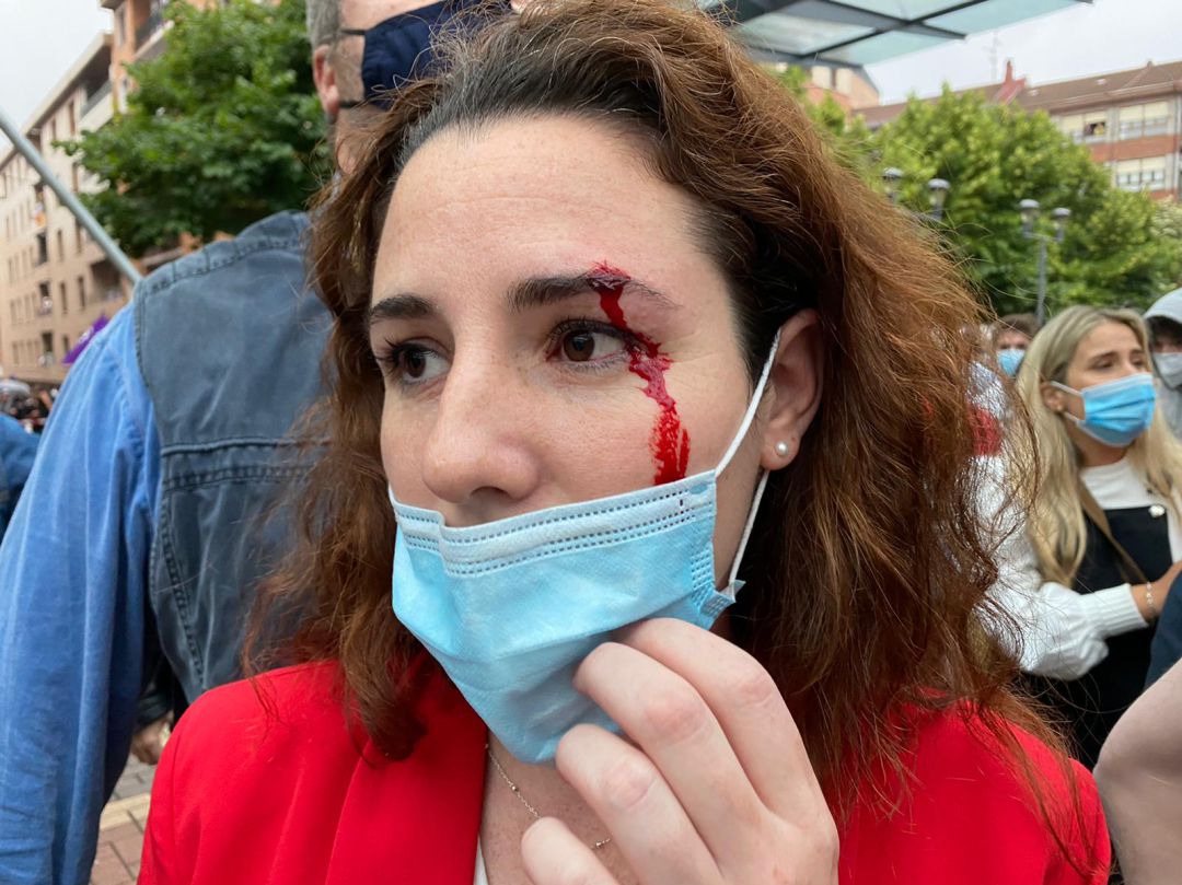 Rocio de Meer recibió una pedrada en la ceja izquierda Rocio de Meer recibió una pedrada en la ceja izquierda