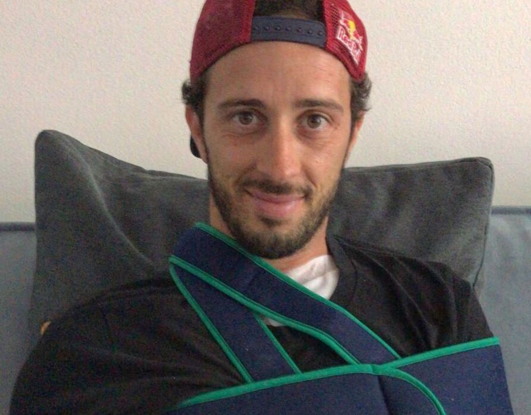 Andrea Dovizioso tras pasar por el quirófano Andrea Dovizioso tras pasar por el quirófano