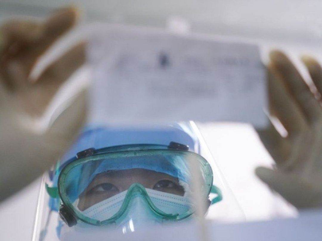 Un sanitario observa una prueba de covid. Un sanitario observa una prueba de covid.