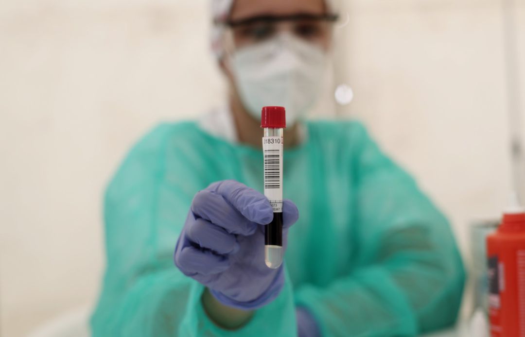 Un sanitario muestra un tubo de ensayo con muestras de un paciente que se realizó un test para detectar coronavirus. Un sanitario muestra un tubo de ensayo con muestras de un paciente que se realizó un test para detectar coronavirus.