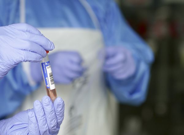 Un sanitario protegido con guantes sostiene un muestra para realizar una prueba PCR (Archivo)