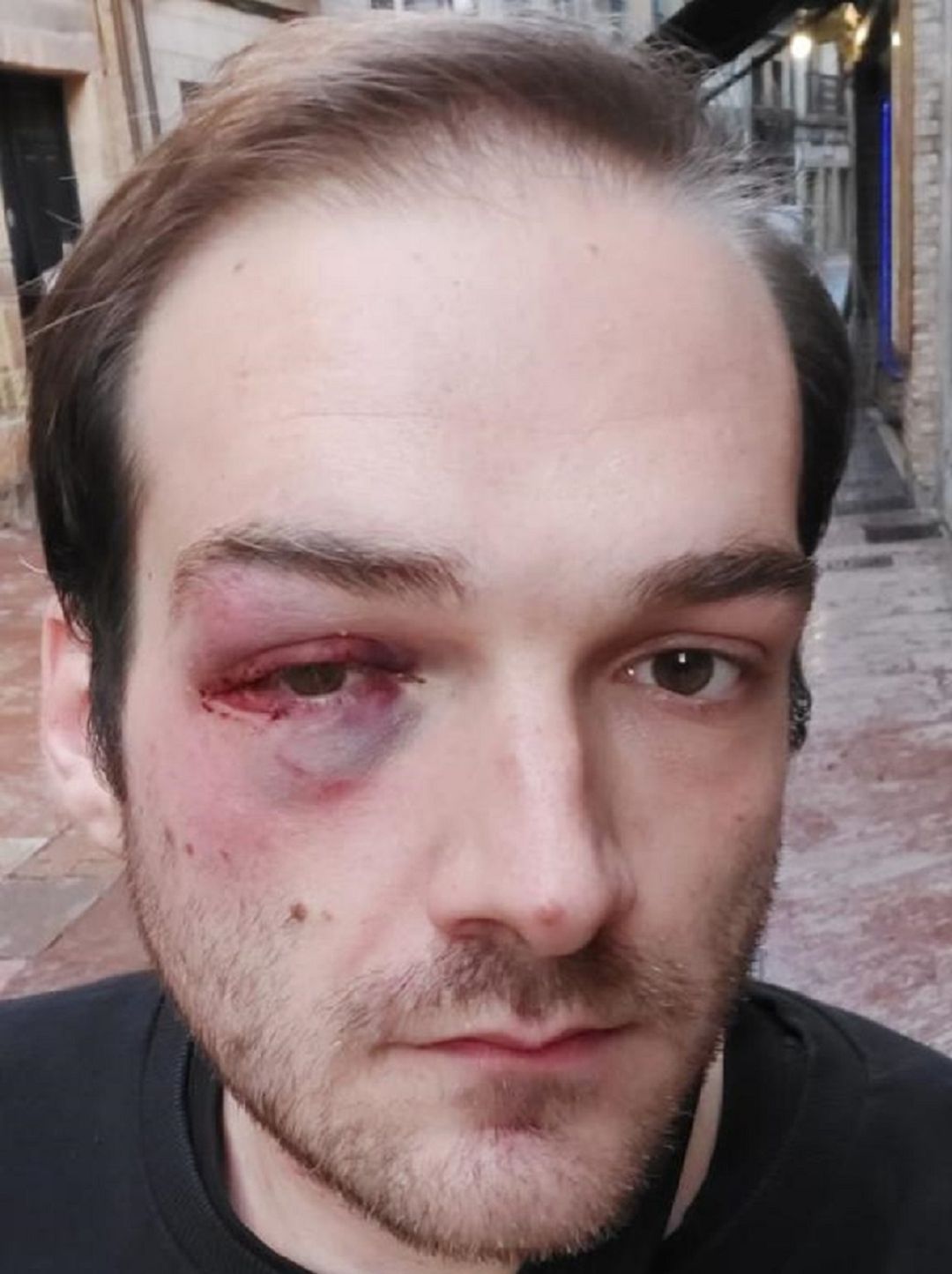 El joven ha publicado en sus redes sociales la agresión recibida. El joven ha publicado en sus redes sociales la agresión recibida.