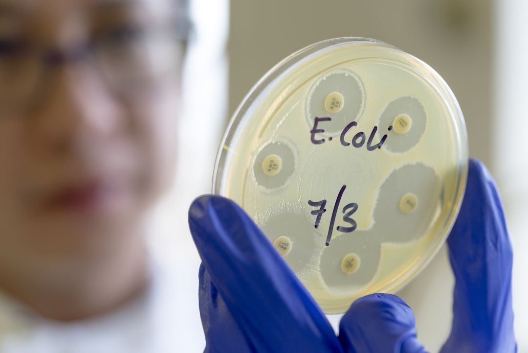 E.coli E.coli