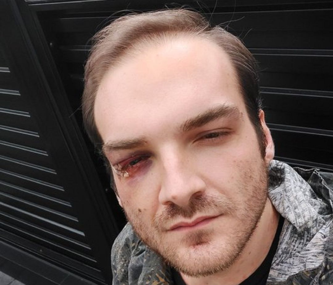 El joven agredido. El joven agredido.