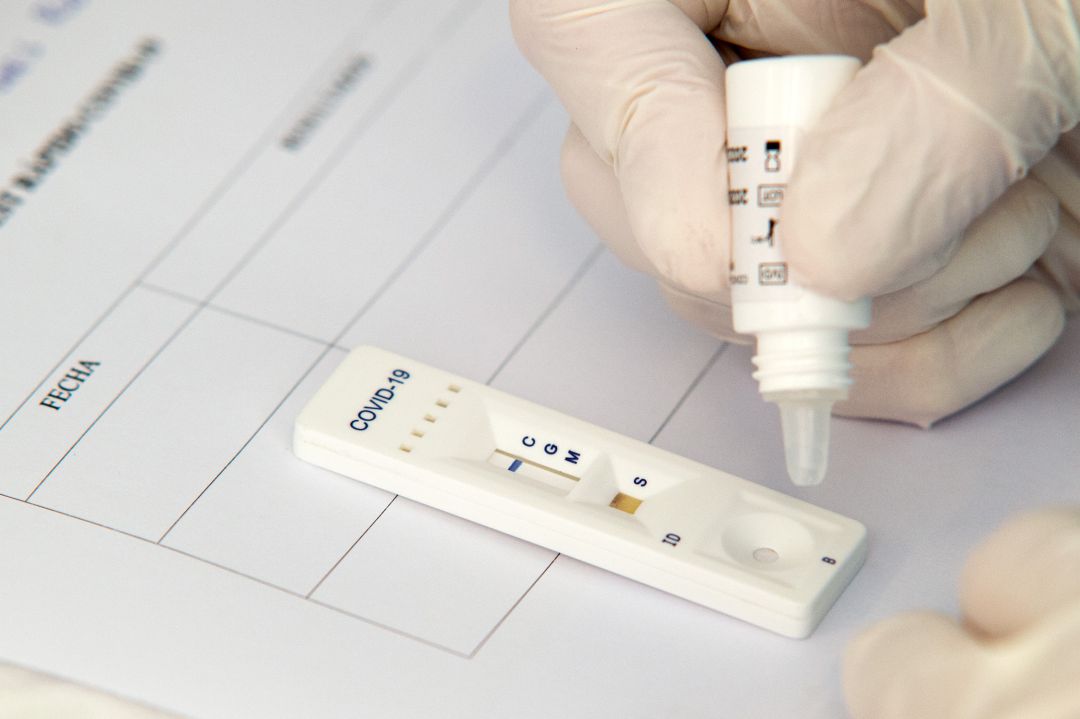 Prueba de coronavirus Prueba de coronavirus