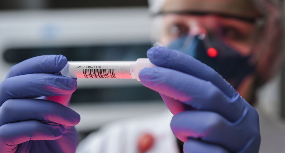 Un sanitario observa una muestra de Covid-19. Un sanitario observa una muestra de Covid-19.