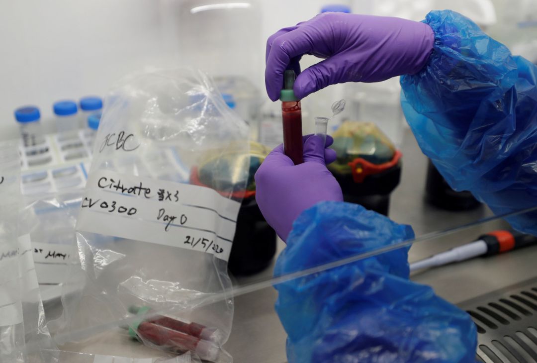 Blood samples from patients infected with the coronavirus disease (COVID-19) are prepared for analysis in the Blood Processing Lab in the Cambridge Institute of Therapeutic Immunology and Infectious Disease, in Cambridge, Britain May 21, 2020 Blood samples from patients infected with the coronavirus disease (COVID-19) are prepared for analysis in the Blood Processing Lab in the Cambridge Institute of Therapeutic Immunology and Infectious Disease, in Cambridge, Britain May 21, 2020
