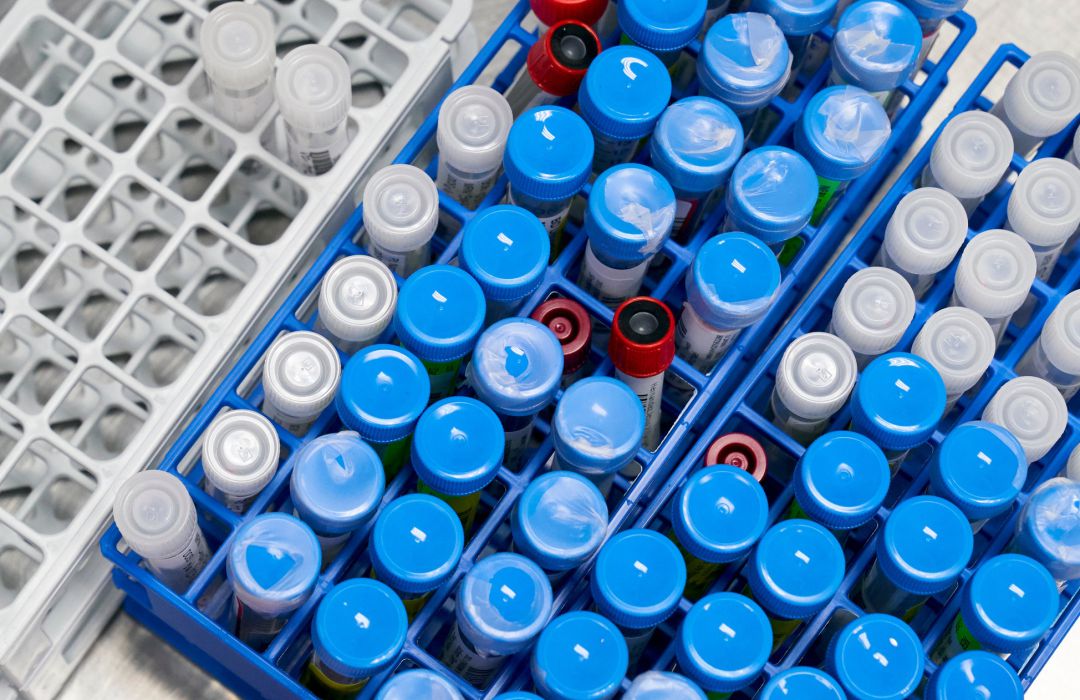 Varias muestras de test de coronavirus. Varias muestras de test de coronavirus.