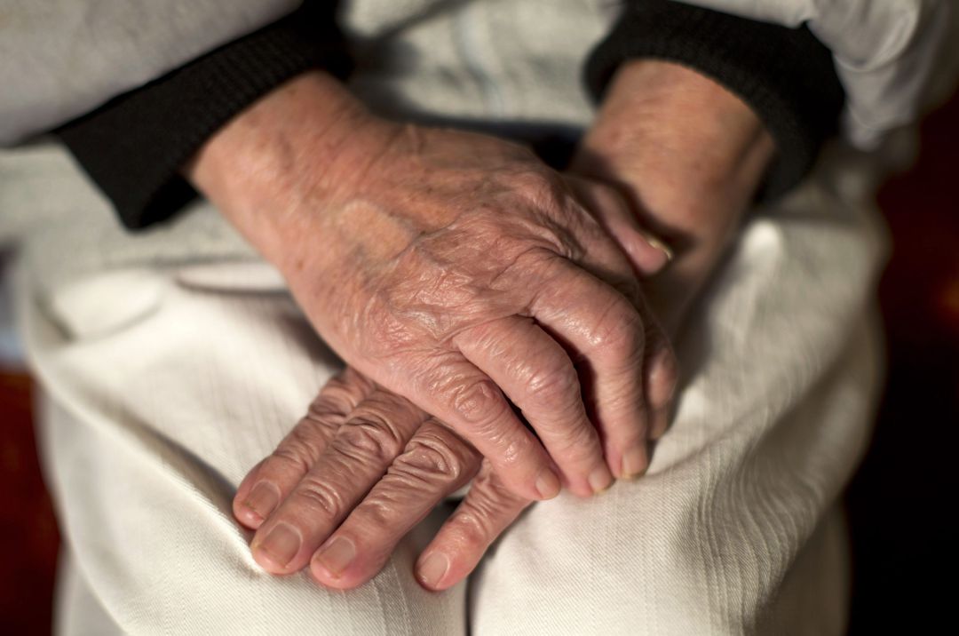 Una enferma de Alzheimer. Una enferma de Alzheimer.