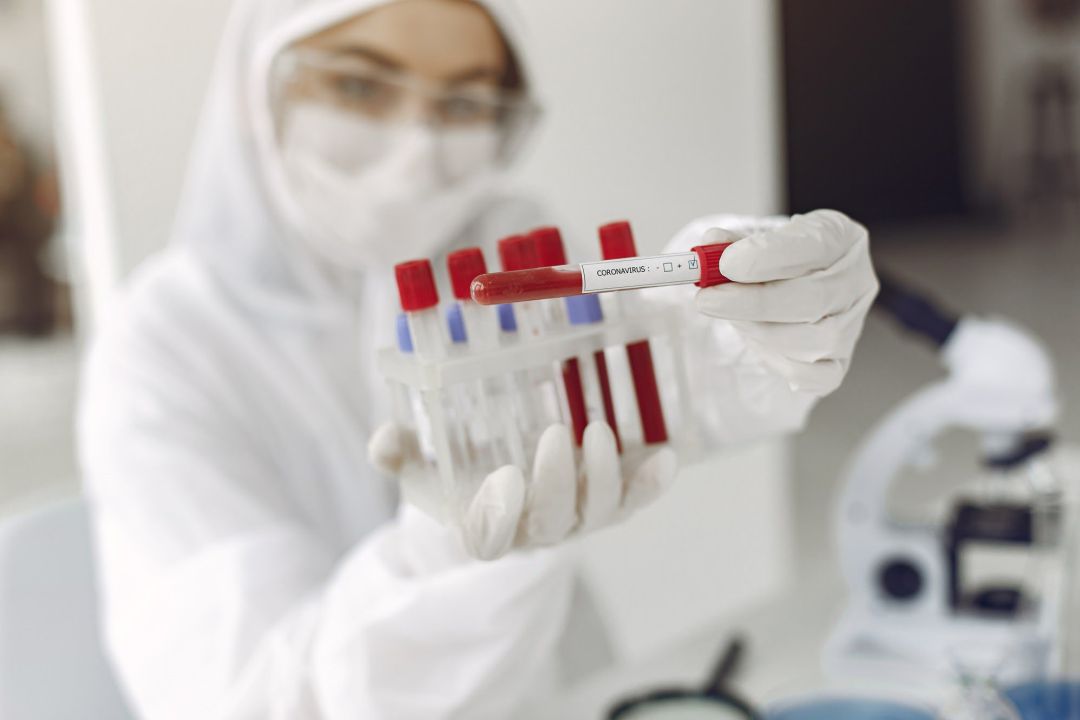 Imagen de recurso de una investigadora mostrando pruebas de muestras de coronavirus. Imagen de recurso de una investigadora mostrando pruebas de muestras de coronavirus.