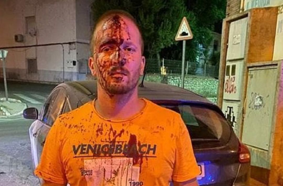 Imágen difundida por whatsapp sobre la supuesta agresión a un vecino de Totana Imágen difundida por whatsapp sobre la supuesta agresión a un vecino de Totana