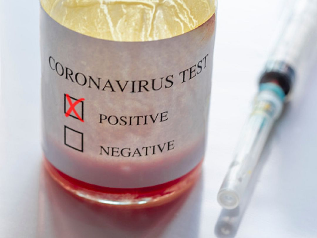 Test de coronavirus Test de coronavirus