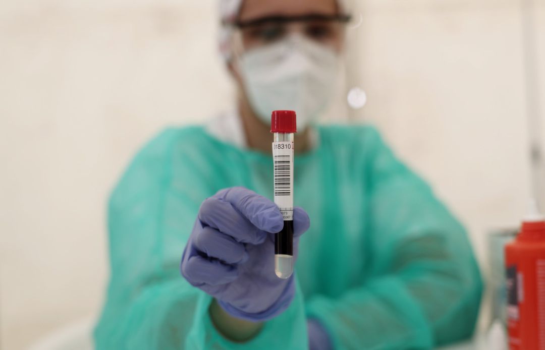 Un sanitario muestra un tubo de ensayo con muestras de una prueba Un sanitario muestra un tubo de ensayo con muestras de una prueba