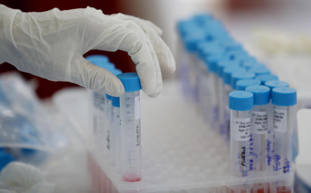 Pruebas de coronavirus Pruebas de coronavirus